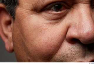 HD Face Skin Umberto Espinar cheek ear eye nose skin…